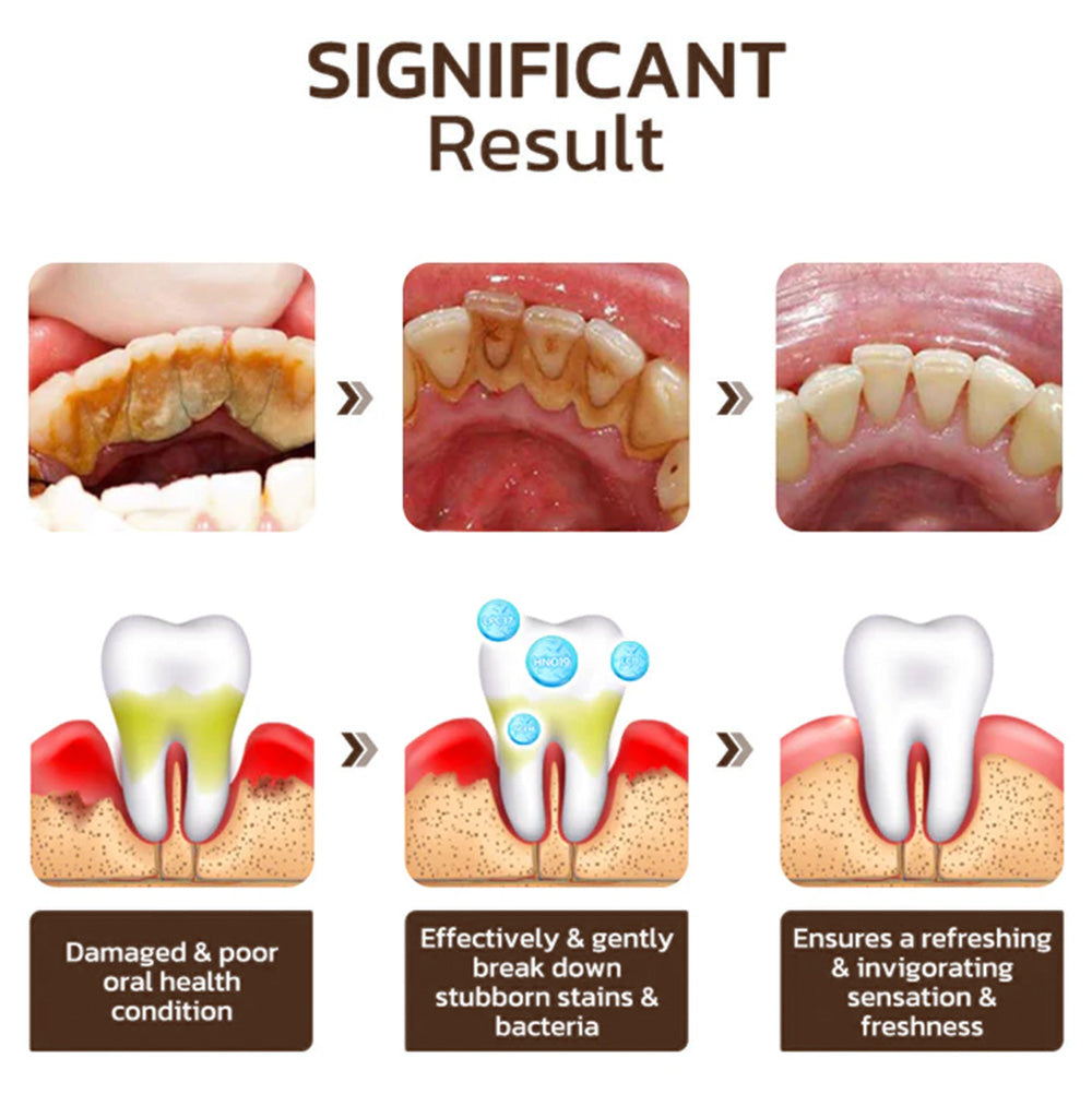 Whitening Toothpaste