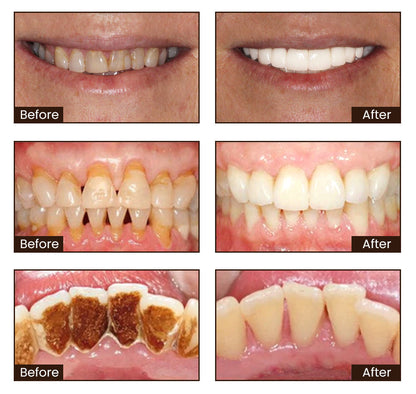 Whitening Toothpaste